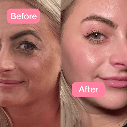 🔥Hot Sale🔥Jelly Face Cream