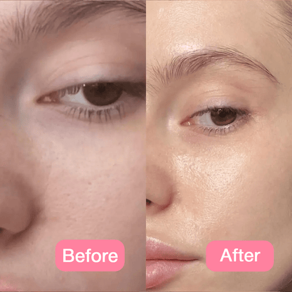 🔥Hot Sale🔥Jelly Face Cream